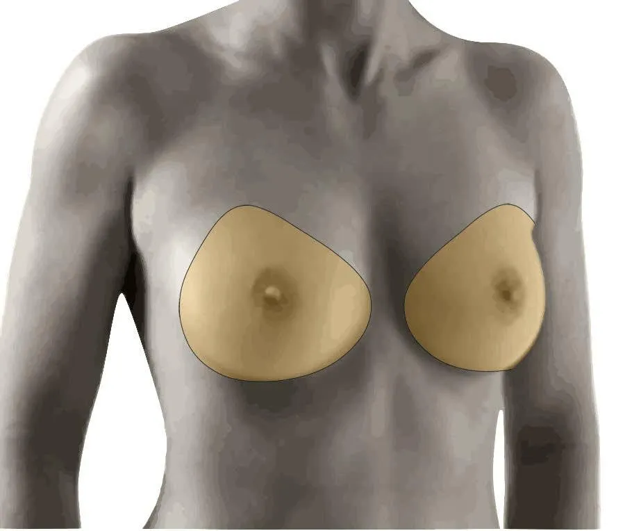 Amoena Natura 3E Breast Form 397